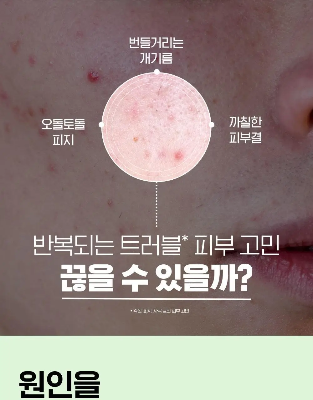 [폼클렌저 150g증정] 아크네스포맨퍼펙트올인원 기획(본품 200ml+폼클렌저 150g) 상세페이지 4